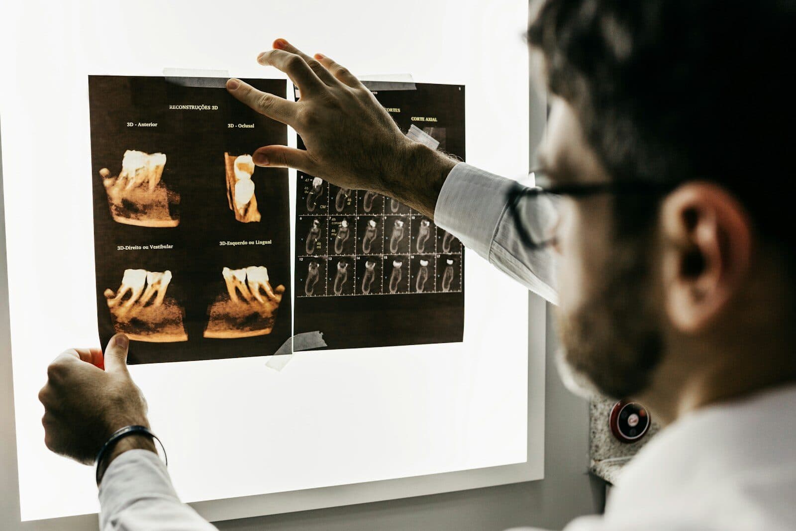 Dentist holding dental x-ray films up to a lightbox